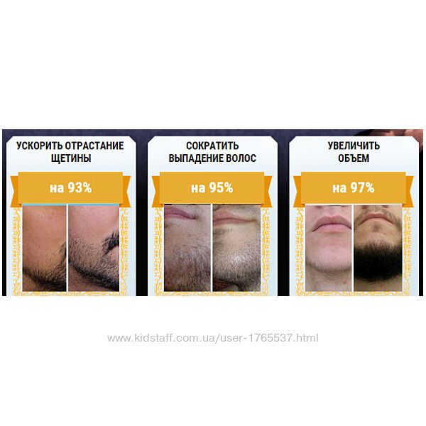 Интенсивный гель для быстрого роста бороды и усов акция 40мл20мл