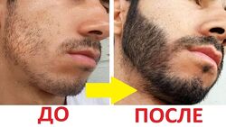 Интенсивный гель для быстрого роста бороды усов волос Италия. 40 мл